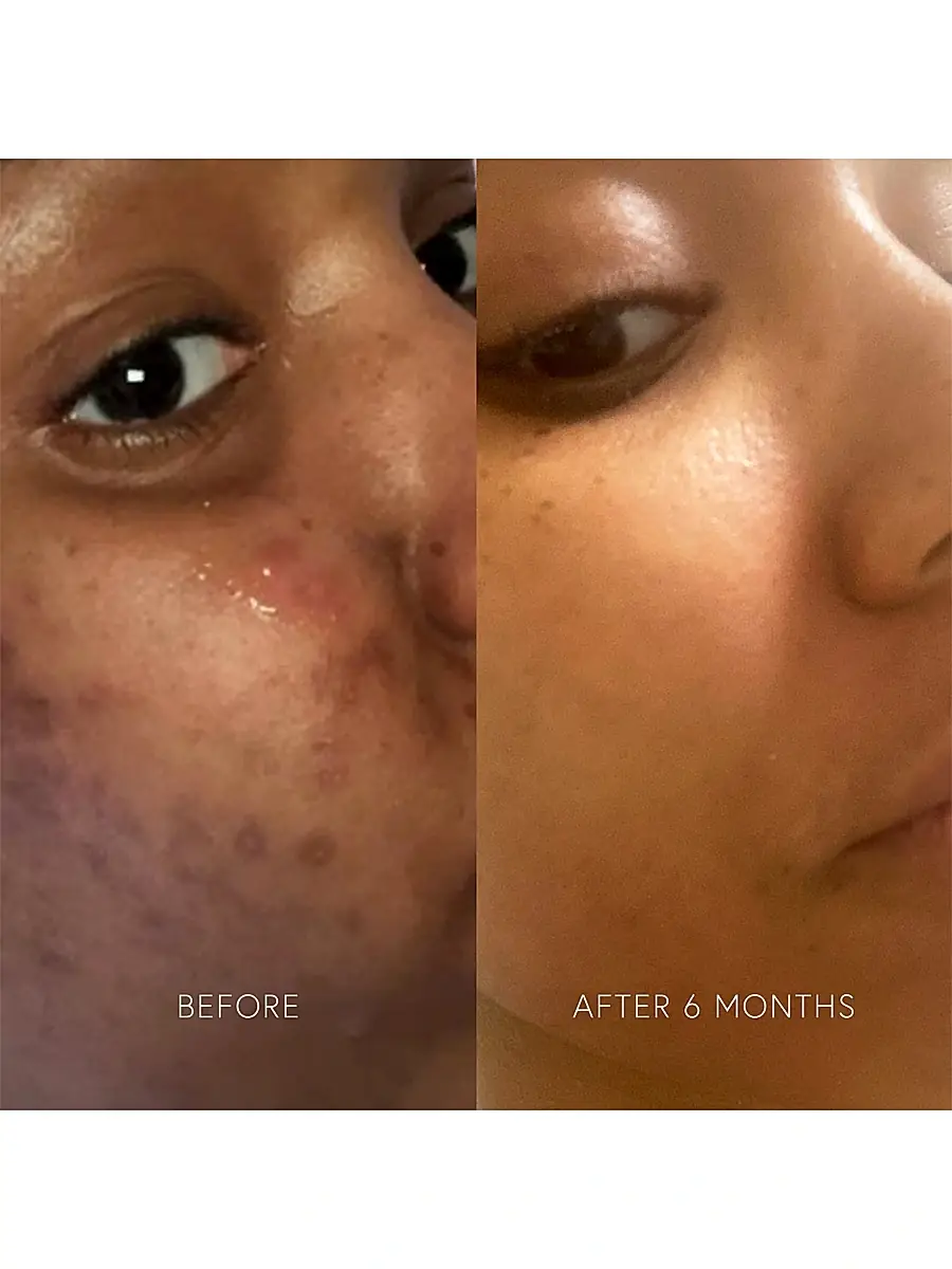 Dr. Barbara Sturm Women's Clarifying Mask | Thumbnail 2
