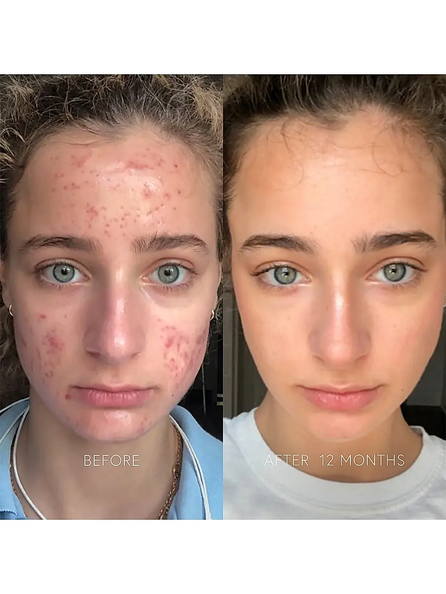 Dr. Barbara Sturm Women's Clarifying Face | Thumbnail 2 Dr. Barbara Sturm Women's Clarifying Face | Thumbnail 2