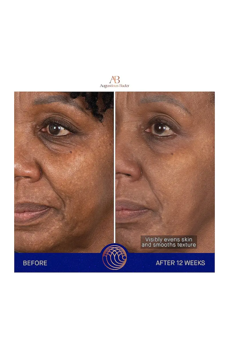 Augustinus Bader The Face Cream Mask | Thumbnail 6