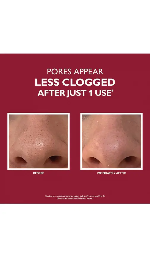 Peter Thomas Roth Even Smoother Microdermabrasion Exfoliating Pore Treatment | Thumbnail 2 Peter Thomas Roth Even Smoother Microdermabrasion Exfoliating Pore Treatment | Thumbnail 2