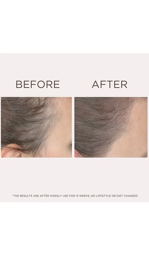 Solaris Laboratories NY Need More Anti-Hair Loss Serum Treatment | Thumbnail 2 Solaris Laboratories NY Need More Anti-Hair Loss Serum Treatment | Thumbnail 2