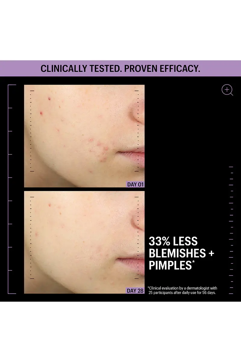 Allies of Skin Azelaic & Kojic Advanced Clarifying Serum 1oz | Thumbnail 4 Allies of Skin Azelaic & Kojic Advanced Clarifying Serum 1oz | Thumbnail 4