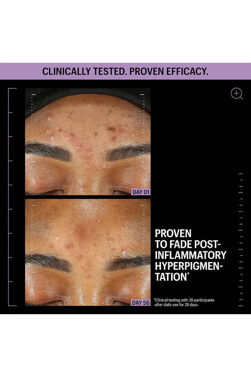 Allies of Skin Azelaic & Kojic Advanced Clarifying Serum 1oz | Thumbnail 5 Allies of Skin Azelaic & Kojic Advanced Clarifying Serum 1oz | Thumbnail 5