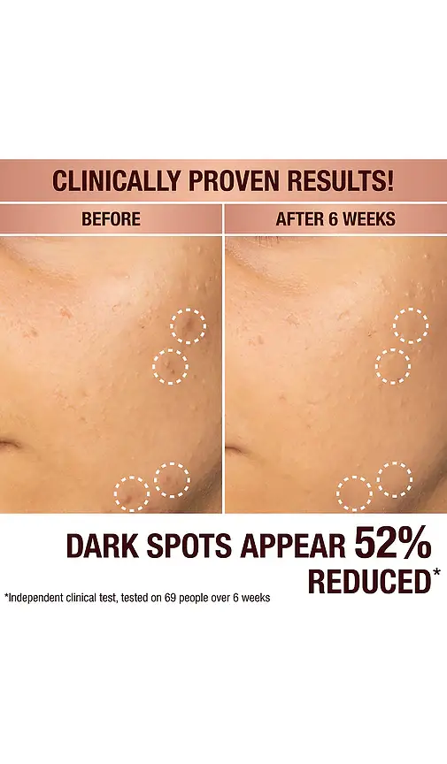 Charlotte Tilbury Dark Spot Correcting Radiance Recovery Serum 10ml | Thumbnail 2 Charlotte Tilbury Dark Spot Correcting Radiance Recovery Serum 10ml | Thumbnail 2