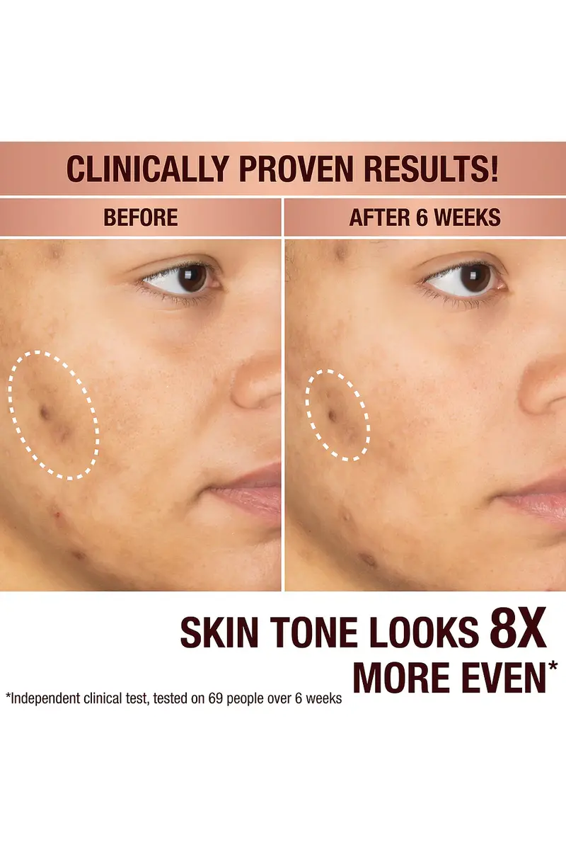 Charlotte Tilbury Dark Spot Correcting Radiance Recovery Serum 10ml | Thumbnail 5 Charlotte Tilbury Dark Spot Correcting Radiance Recovery Serum 10ml | Thumbnail 5
