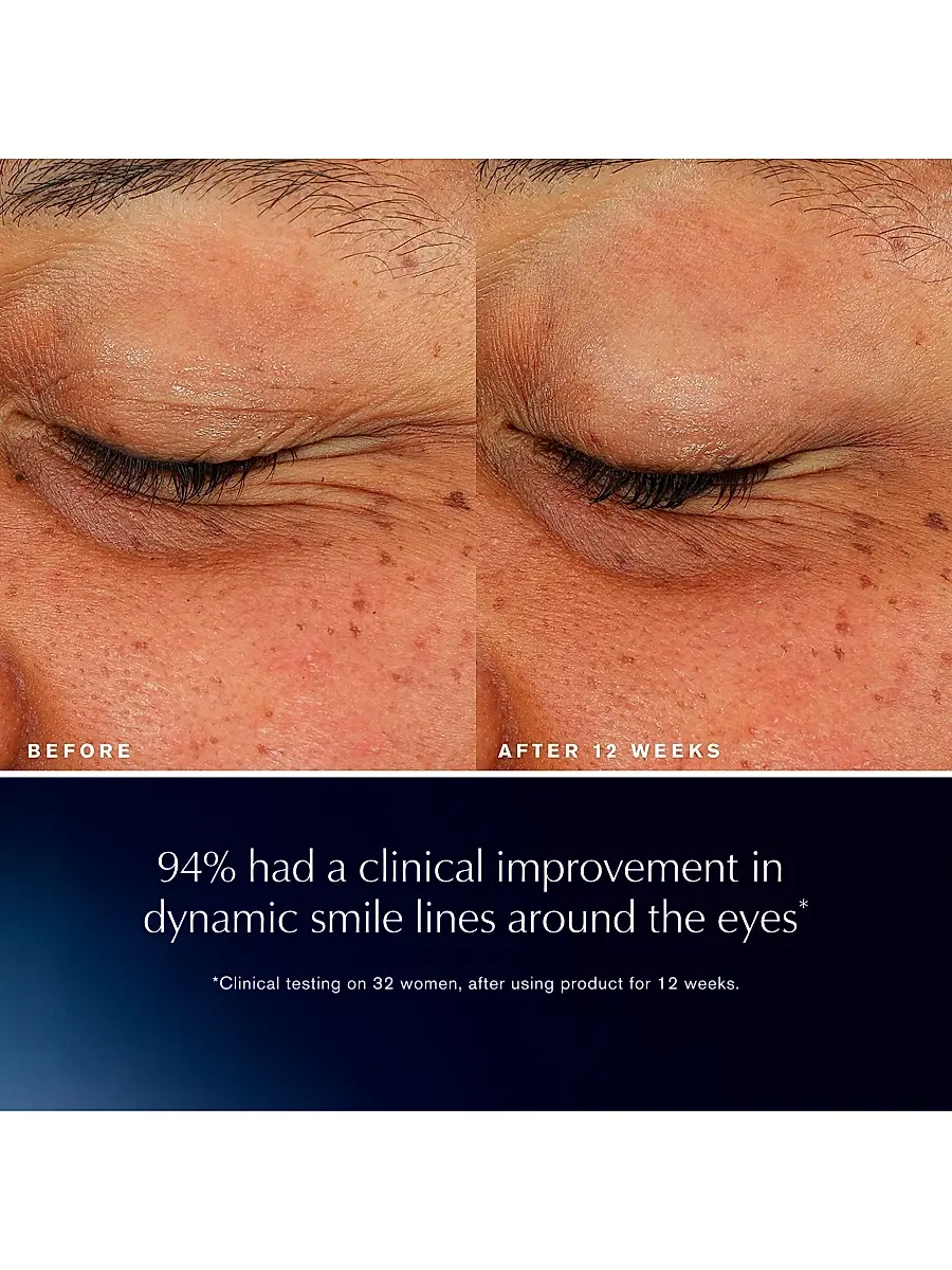 Estée Lauder Women's Advanced Night Repair Eye Lift + Sculpt Eye | Thumbnail 4 Estée Lauder Women's Advanced Night Repair Eye Lift + Sculpt Eye | Thumbnail 4