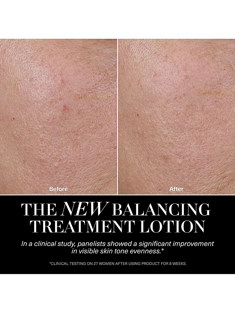 La Mer The Balancing Treatment Lotion | Thumbnail 5