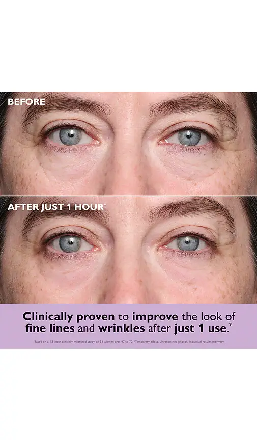Peter Thomas Roth Instant FIRMx Collagen Infusion Tightening Eye Patches 8 Pairs | Thumbnail 2 Peter Thomas Roth Instant FIRMx Collagen Infusion Tightening Eye Patches 8 Pairs | Thumbnail 2