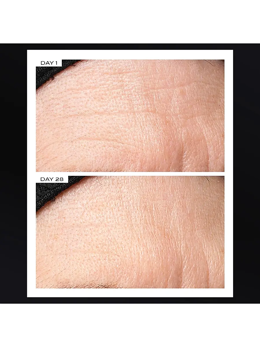 111SKIN Exosome Face Lift Protocol | Thumbnail 8 111SKIN Exosome Face Lift Protocol | Thumbnail 8