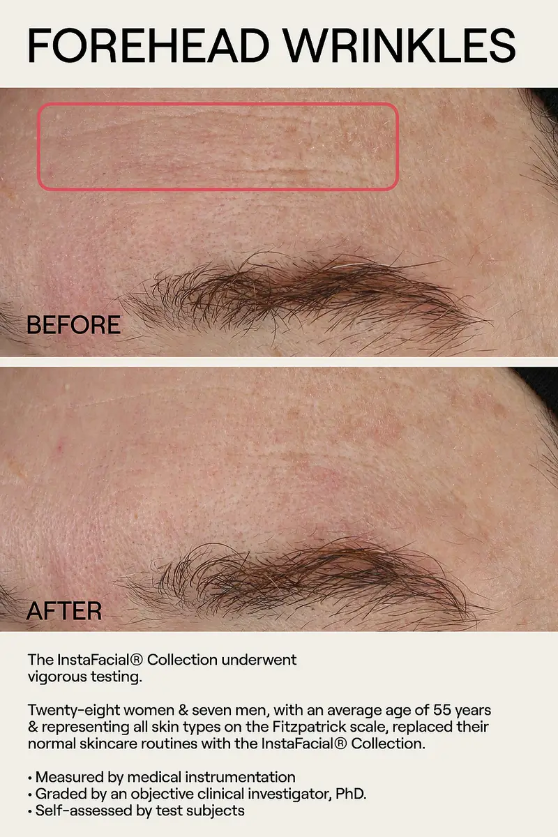 Dr. Diamond's Metacine Instafacial Plasma Bioactive Growth Factor Serum 15ml | Thumbnail 3