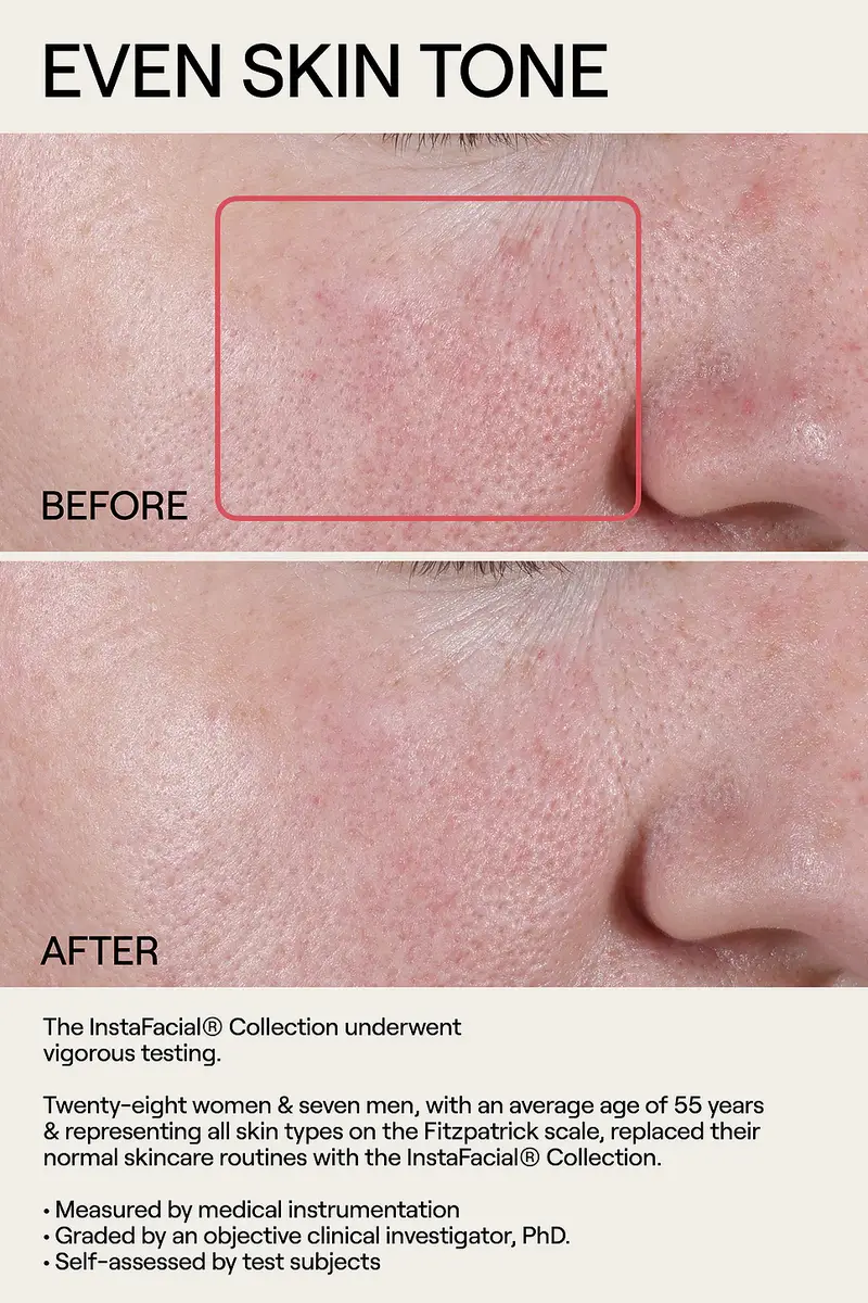 Dr. Diamond's Metacine Instafacial Plasma Bioactive Growth Factor Serum 15ml | Thumbnail 4