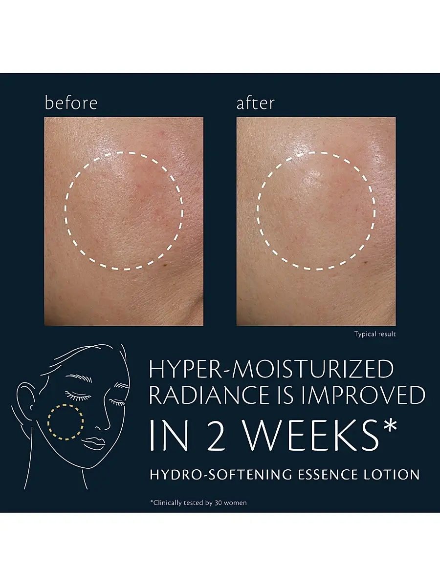 CLÉ DE PEAU BEAUTÉ Hydro-Softening Essence Lotion | Thumbnail 5 CLÉ DE PEAU BEAUTÉ Hydro-Softening Essence Lotion | Thumbnail 5