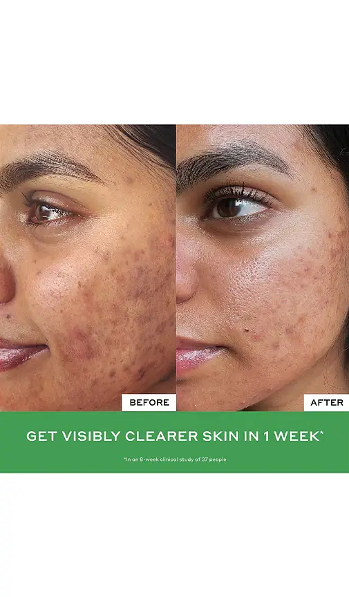 OLEHENRIKSEN Daily D-Clog Pore-Clearing Cleanser | Thumbnail 2