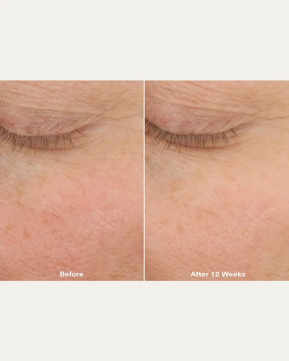 La Mer The Micro Peel Treatment, 1 oz. | Thumbnail 4