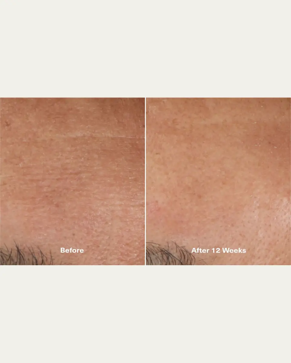 La Mer The Moisturizing Soft Cream, 8.5 oz. | Thumbnail 4 La Mer The Moisturizing Soft Cream, 8.5 oz. | Thumbnail 4