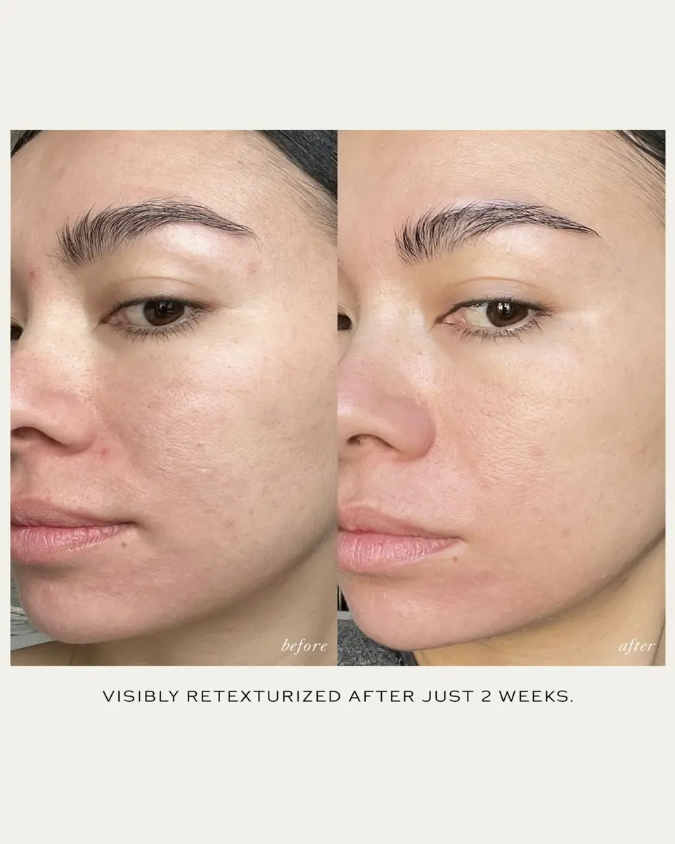 Westman Atelier Rollerball Skin Activator | Thumbnail 4 Westman Atelier Rollerball Skin Activator | Thumbnail 4