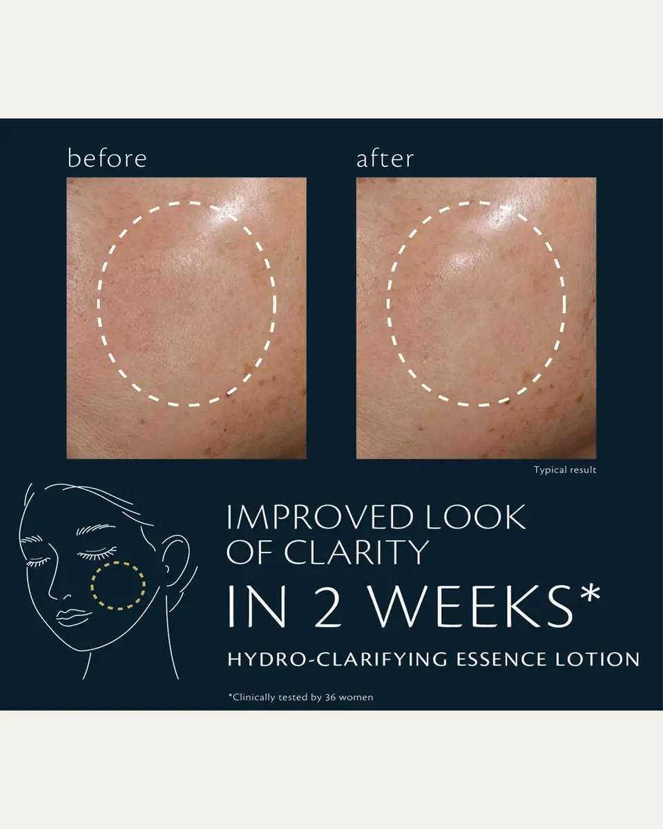 CLÉ DE PEAU BEAUTÉ Hydro-Clarifying Essence Lotion, 5.7 oz. | Thumbnail 3 CLÉ DE PEAU BEAUTÉ Hydro-Clarifying Essence Lotion, 5.7 oz. | Thumbnail 3