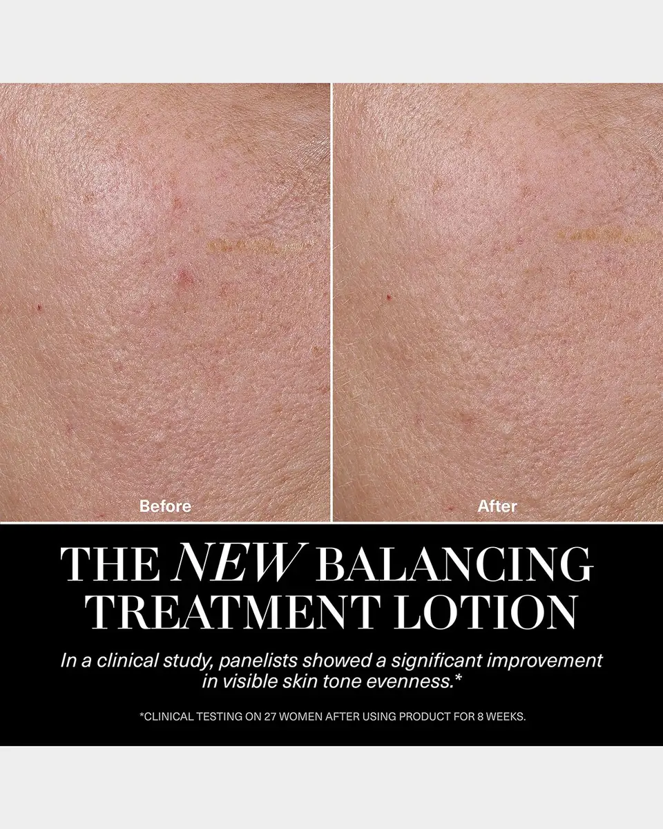 La Mer The Balancing Treatment Lotion, 5 oz. | Thumbnail 5