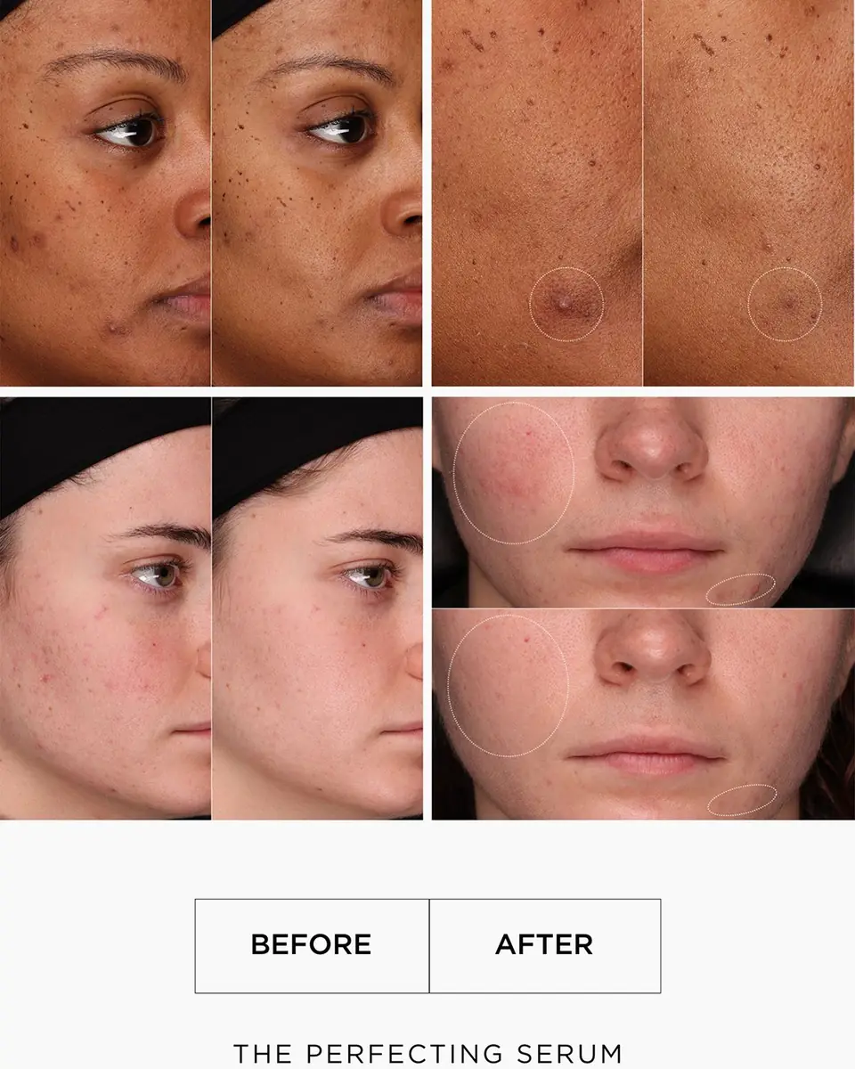LALAIS The Perfecting Serum, 0.5 oz. | Thumbnail 4 LALAIS The Perfecting Serum, 0.5 oz. | Thumbnail 4