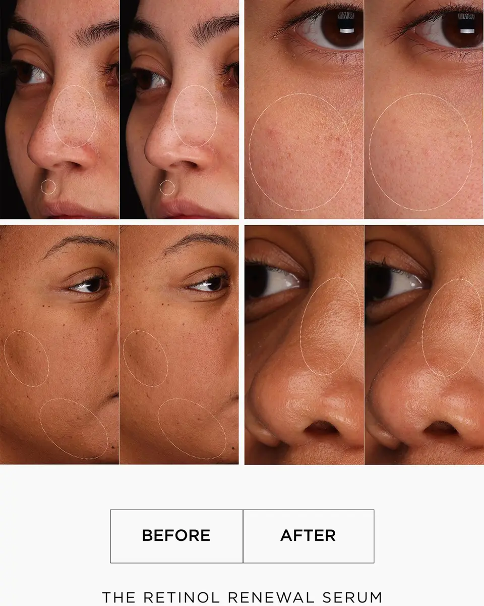 LALAIS The Retinol Renewal, 1 oz. | Thumbnail 5 LALAIS The Retinol Renewal, 1 oz. | Thumbnail 5