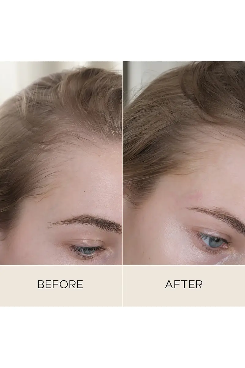 Christophe Robin Fortifying Scalp Serum With Amaranth Peptides | Thumbnail 5