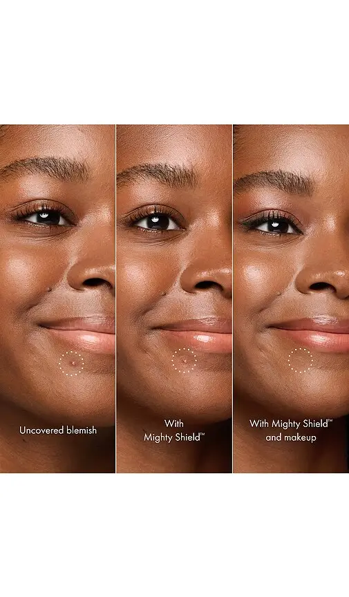 Hero Cosmetics Mighty Shield Invisible Blemish Protectant | Thumbnail 2 Hero Cosmetics Mighty Shield Invisible Blemish Protectant | Thumbnail 2