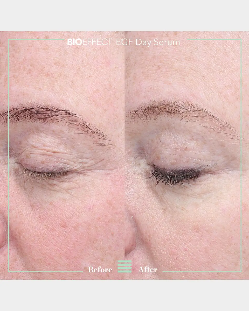 Bioeffect EGF Day Serum, 1 oz. | Thumbnail 6