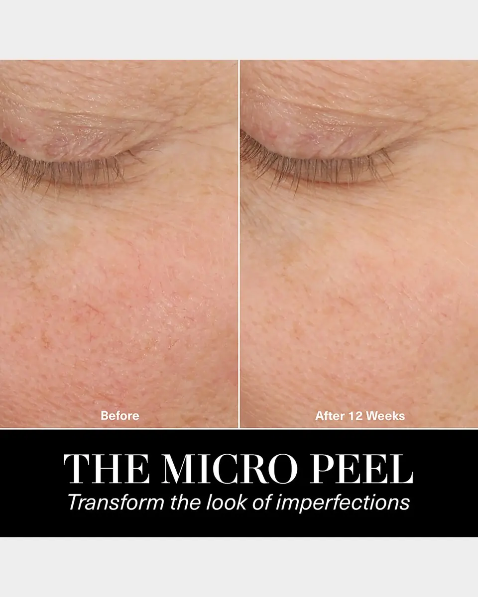 La Mer The Micro Peel Treatment, 1 oz. | Thumbnail 8