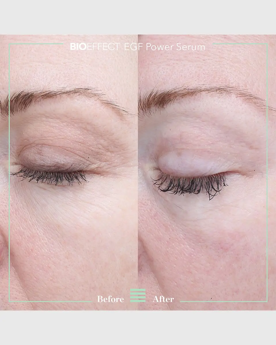 Bioeffect EGF Power Serum, 0.5 oz. | Thumbnail 7 Bioeffect EGF Power Serum, 0.5 oz. | Thumbnail 7