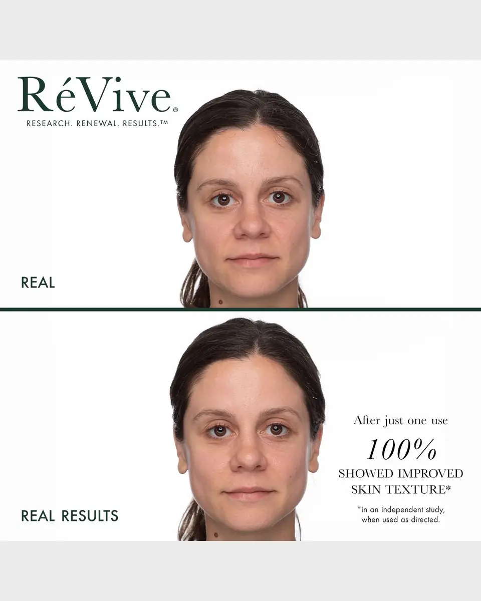 RéVive Masque De Brilliance, 2.4 oz. | Thumbnail 5 RéVive Masque De Brilliance, 2.4 oz. | Thumbnail 5