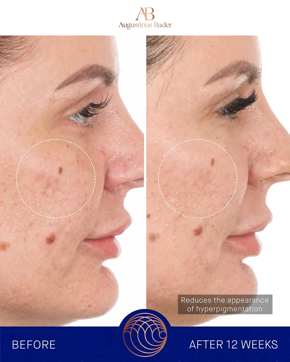 Augustinus Bader The Retinol Serum, 1 oz. | Thumbnail 3