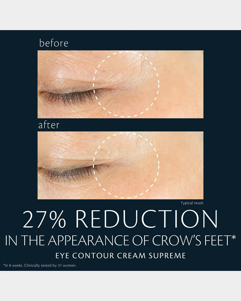 CLÉ DE PEAU BEAUTÉ Eye Contour Cream Supreme, 0.5 oz. | Thumbnail 6