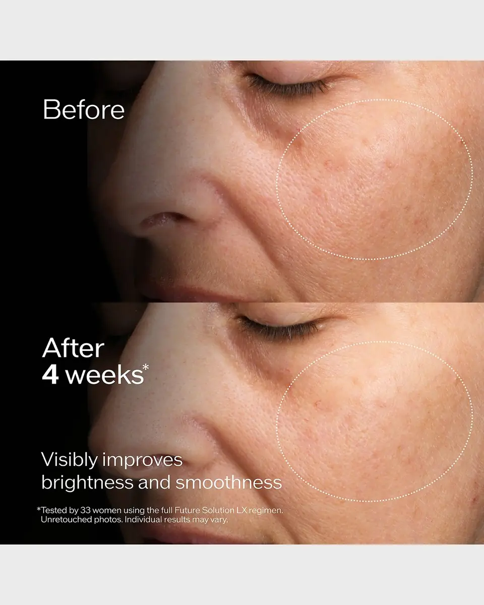 Shiseido Future Solution LX Concentrated Brightening Softener, 5.7 oz. | Thumbnail 3 Shiseido Future Solution LX Concentrated Brightening Softener, 5.7 oz. | Thumbnail 3
