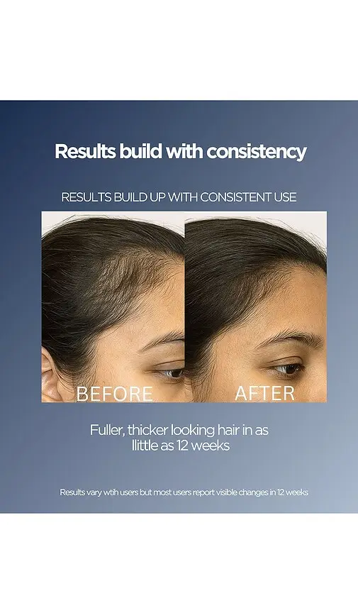 Solaris Laboratories NY Intensive LED Hair Growth Brush | Thumbnail 4 Solaris Laboratories NY Intensive LED Hair Growth Brush | Thumbnail 4