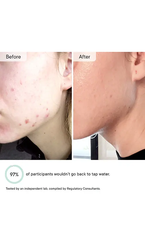 Qure Skincare Faucet Filter | Thumbnail 7 Qure Skincare Faucet Filter | Thumbnail 7