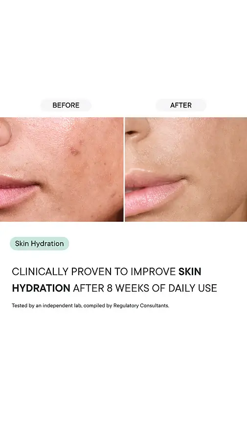 Qure Skincare Shower Filter | Thumbnail 2 Qure Skincare Shower Filter | Thumbnail 2