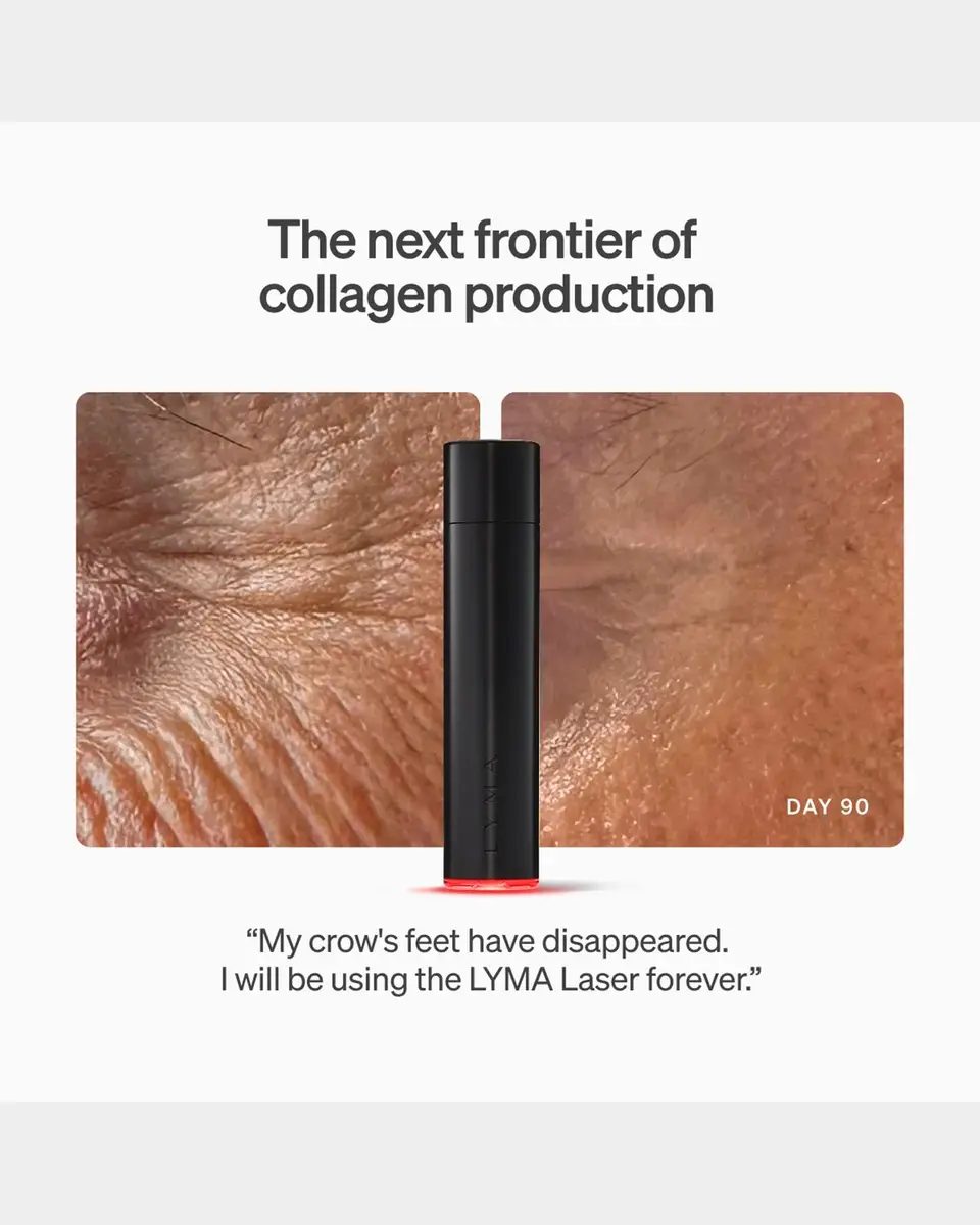 LYMA Laser Starter Kit | Thumbnail 4 LYMA Laser Starter Kit | Thumbnail 4