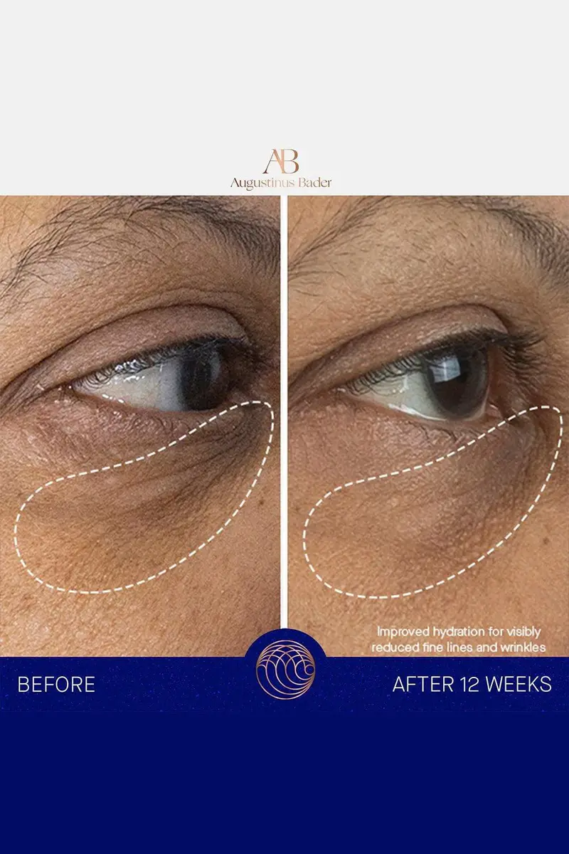 Augustinus Bader The Eye Cream | Thumbnail 5 Augustinus Bader The Eye Cream | Thumbnail 5