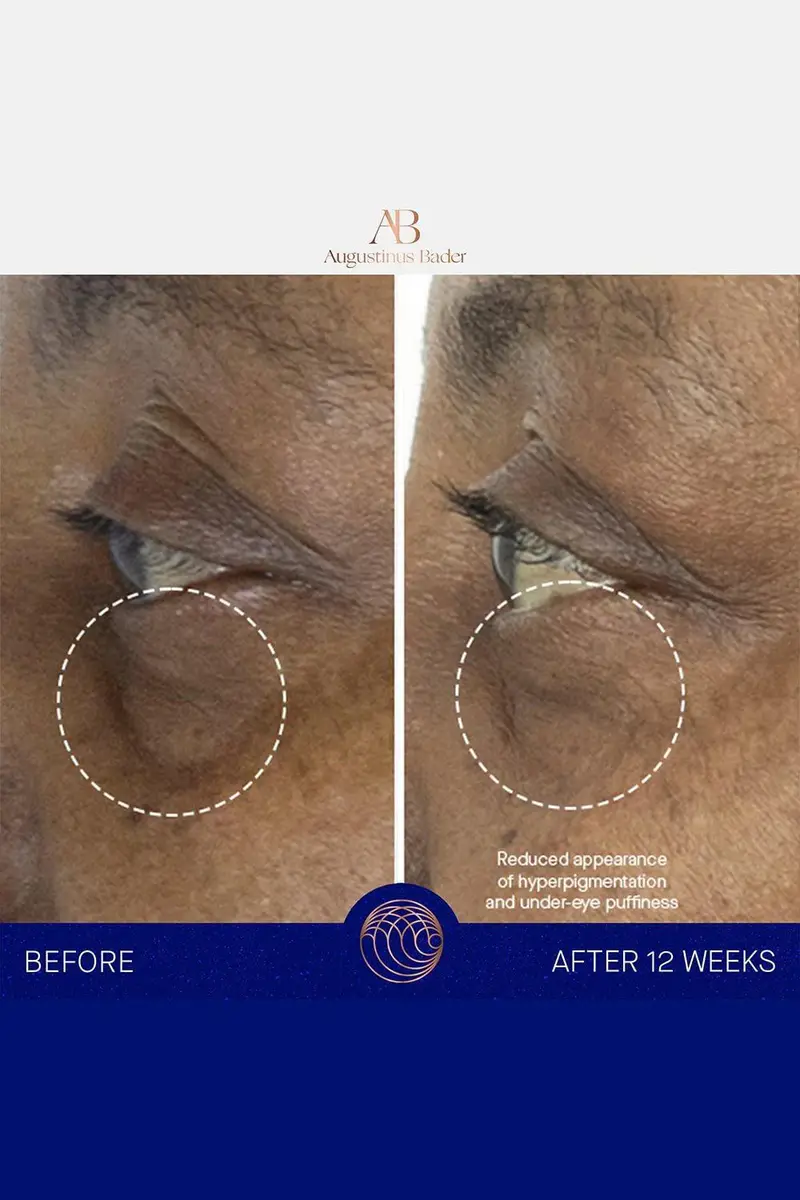 Augustinus Bader The Eye Cream | Thumbnail 7 Augustinus Bader The Eye Cream | Thumbnail 7