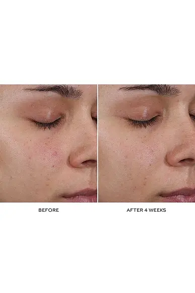 Westman Atelier Pore Refining Complex | Thumbnail 6 Westman Atelier Pore Refining Complex | Thumbnail 6
