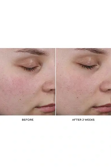 Westman Atelier Pore Refining Complex | Thumbnail 7 Westman Atelier Pore Refining Complex | Thumbnail 7