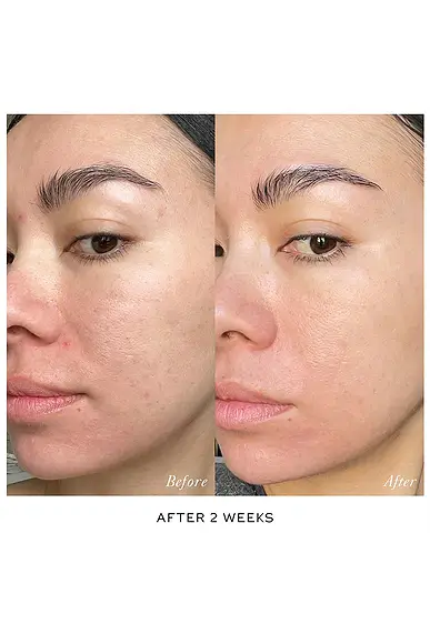 Westman Atelier Skin Activator Serum | Thumbnail 2 Westman Atelier Skin Activator Serum | Thumbnail 2