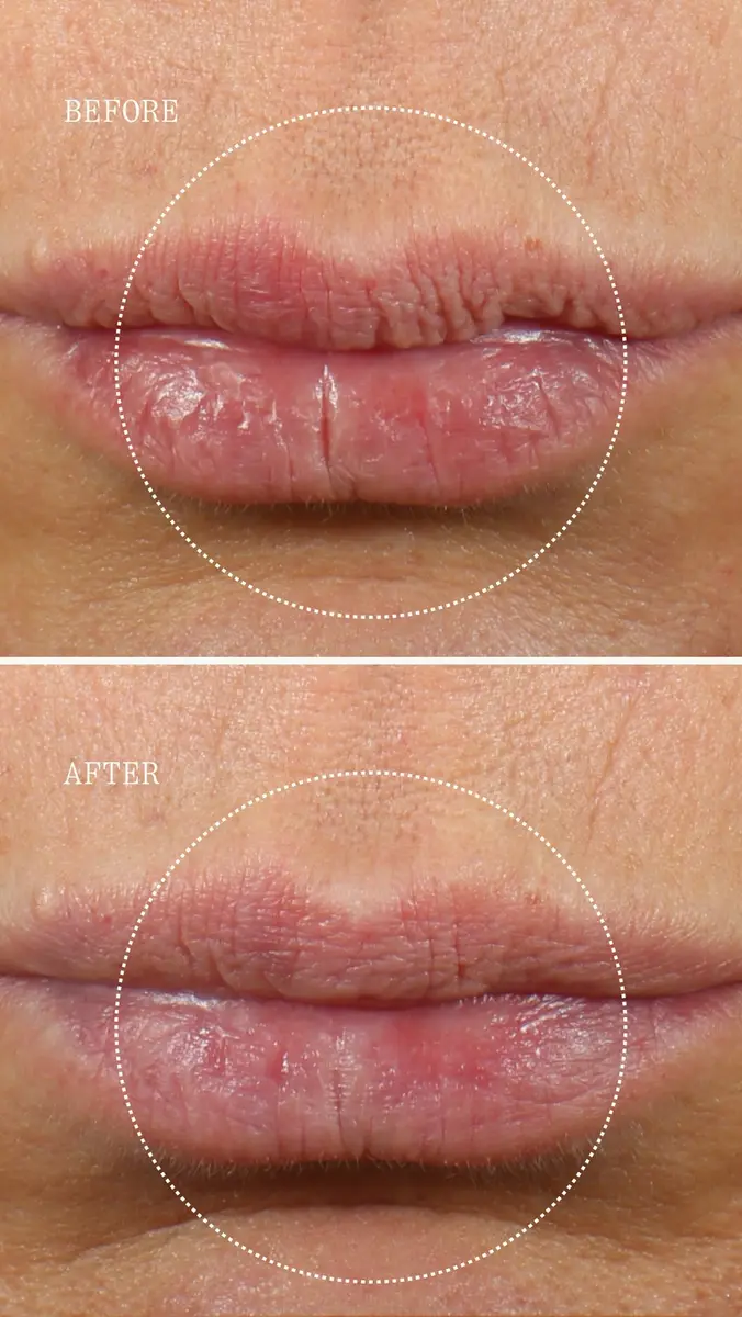 Dr. Marnie Lip Serum | Thumbnail 4 Dr. Marnie Lip Serum | Thumbnail 4