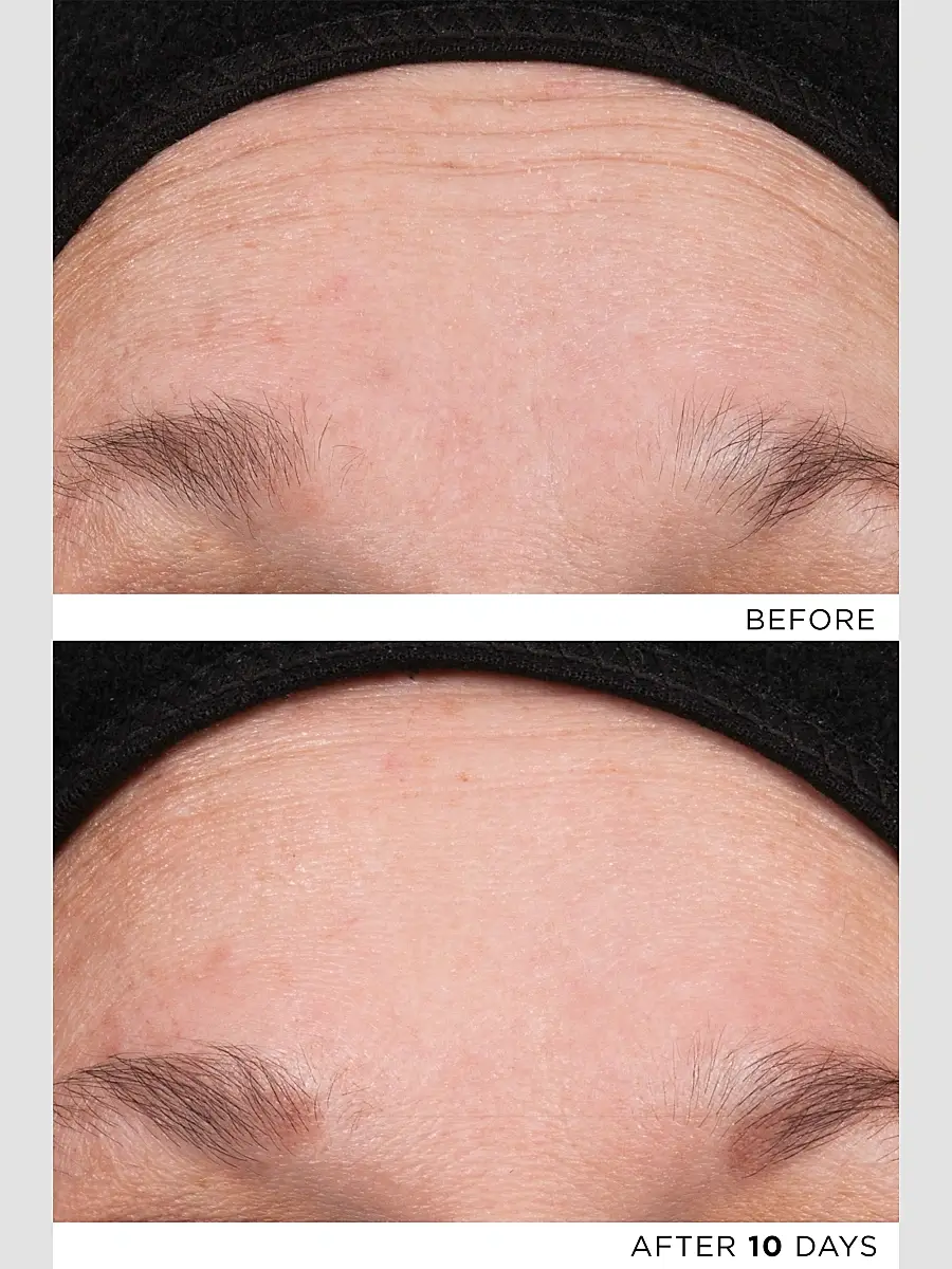 Noble Panacea The Exceptional RetiNAD+ Renewal Booster | Thumbnail 4 Noble Panacea The Exceptional RetiNAD+ Renewal Booster | Thumbnail 4