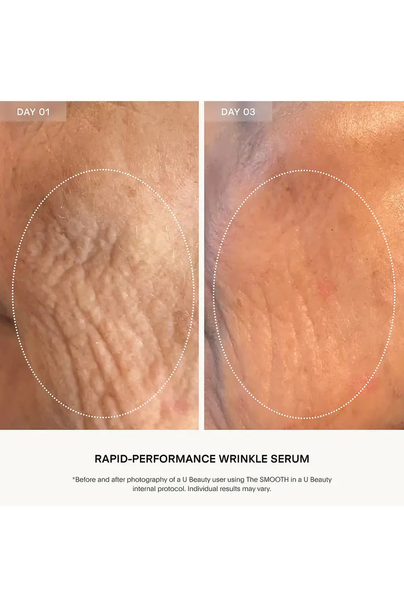 U BEAUTY The SMOOTH Dynamic Wrinkle Defense Serum 15ml | Thumbnail 5