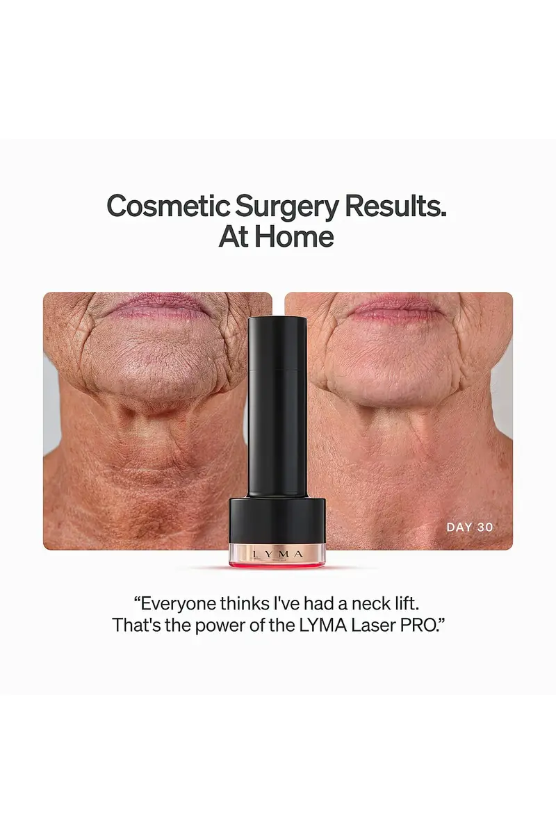 LYMA Laser Pro Starter Kit | Thumbnail 4 LYMA Laser Pro Starter Kit | Thumbnail 4