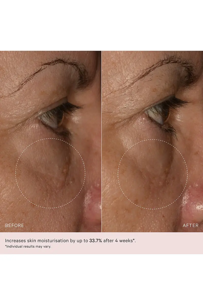 MZ Skin Soothe & Smooth Collagen Activating Eye Complex | Thumbnail 8 MZ Skin Soothe & Smooth Collagen Activating Eye Complex | Thumbnail 8