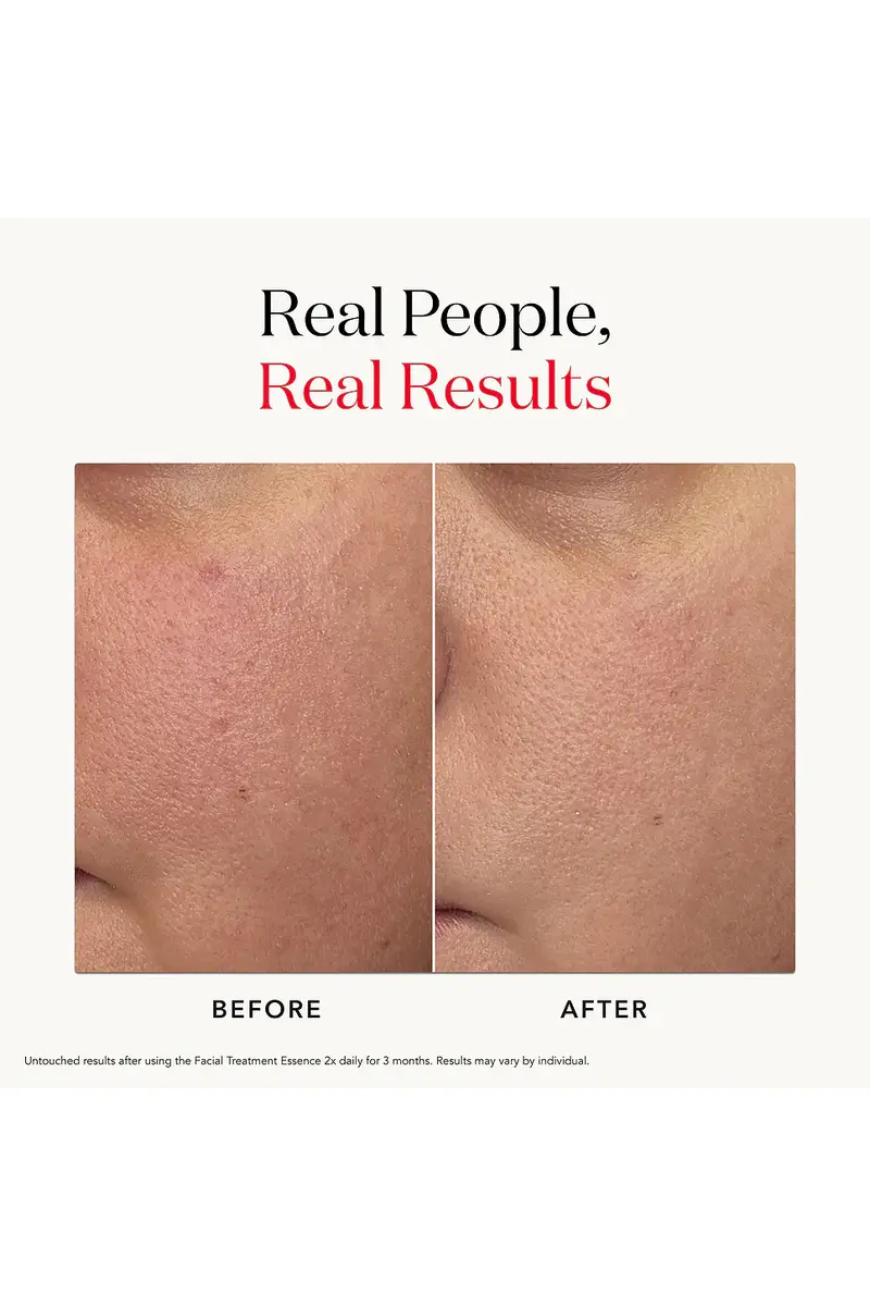 SK-II Facial Treatment Pitera Essence 11 oz | Thumbnail 9