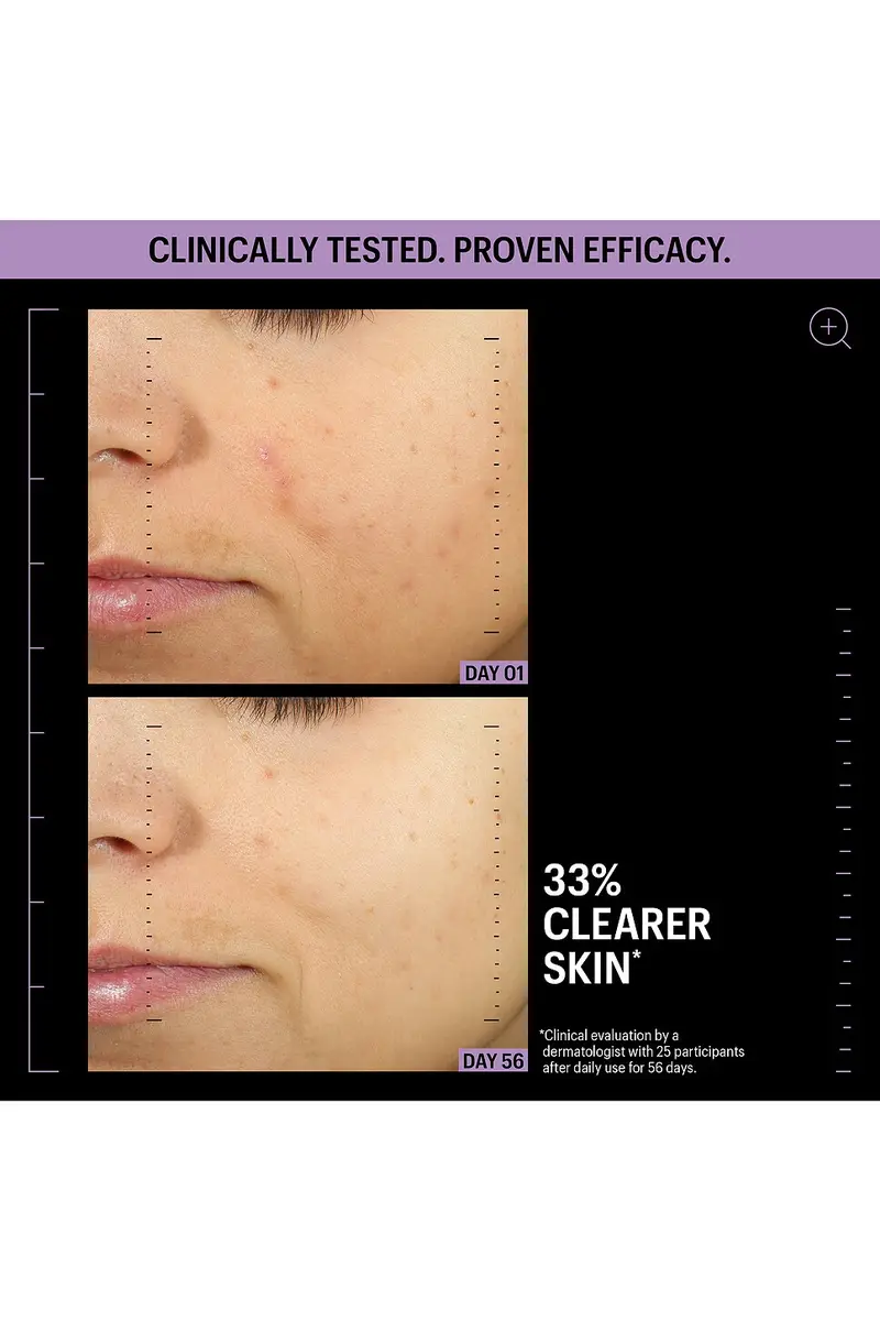 Allies of Skin Azelaic & Kojic Advanced Clarifying Serum 30ml | Thumbnail 7 Allies of Skin Azelaic & Kojic Advanced Clarifying Serum 30ml | Thumbnail 7