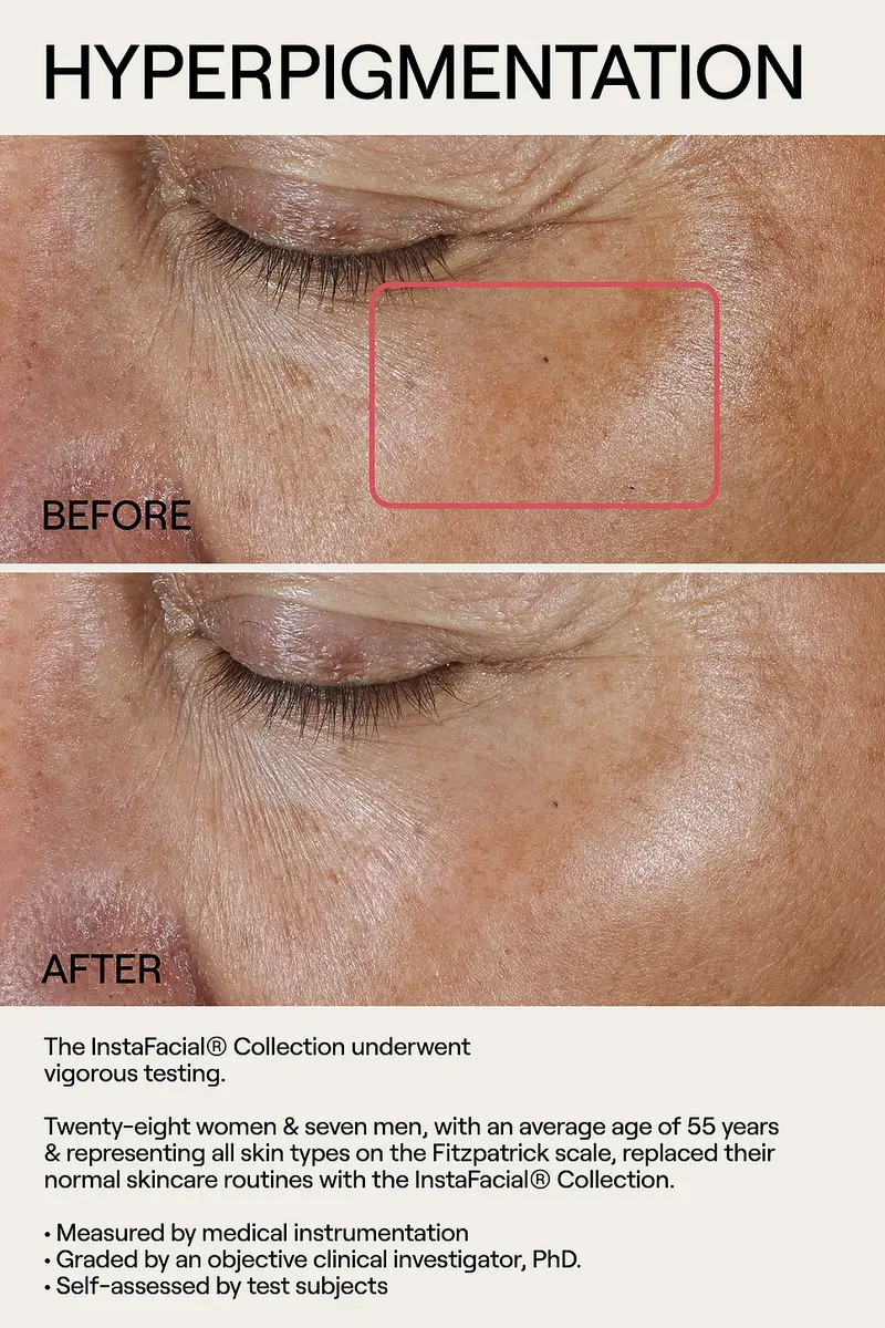 Dr. Diamond's Metacine InstaFacial Plasma Bioactive Growth Factor Serum 30ml | Thumbnail 8 Dr. Diamond's Metacine InstaFacial Plasma Bioactive Growth Factor Serum 30ml | Thumbnail 8